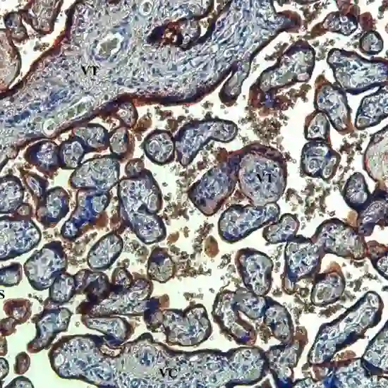 IHC: Placental Alkaline Phosphatase